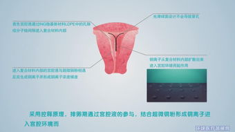 湖北大禹醫(yī)療器械有限責(zé)任公司招商信息與公司簡(jiǎn)介